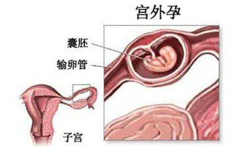 广西找代怀孕机构，2023广西壮族自治区生殖医院供卵试管费用详情公布，附排