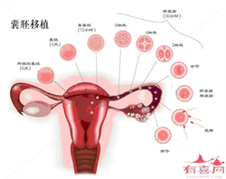 广州哪里捐卵子，广州私立捐卵机构排名，附男生产卵条件列表。